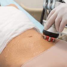 Aparelho de radiofrequência no abdômen